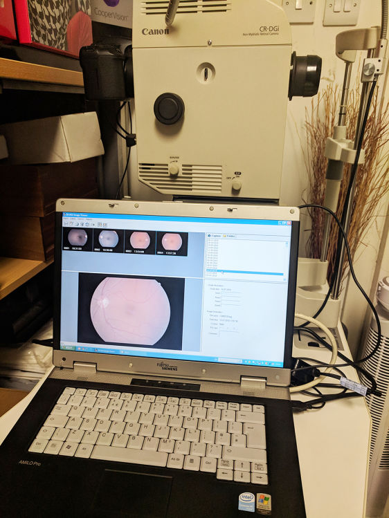 Canon Fundus Camera CR-DGi + laptop + software
