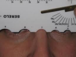 Rees/Serelo Facial Measurement Gauge