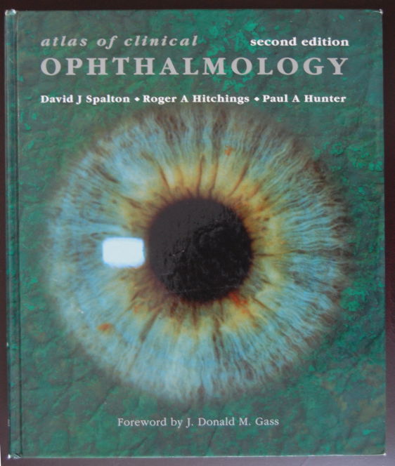 Atlas of Opthalmology