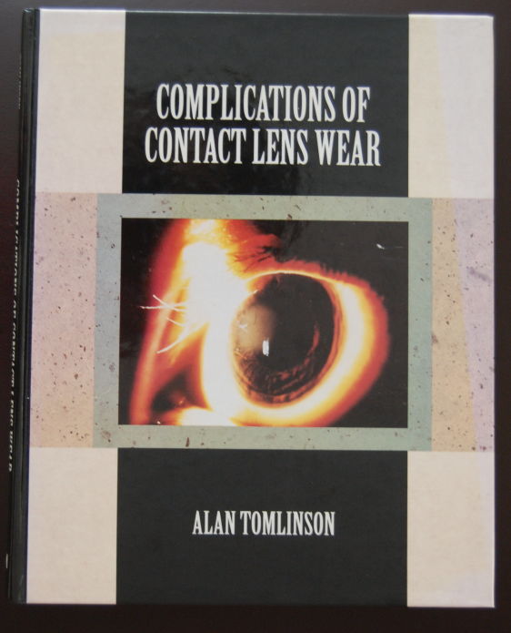 Complications of Contact Lens Wear