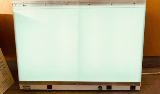 Kenex X-Ray Light Box