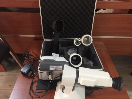 Smartscope Pro Fundus and FA 