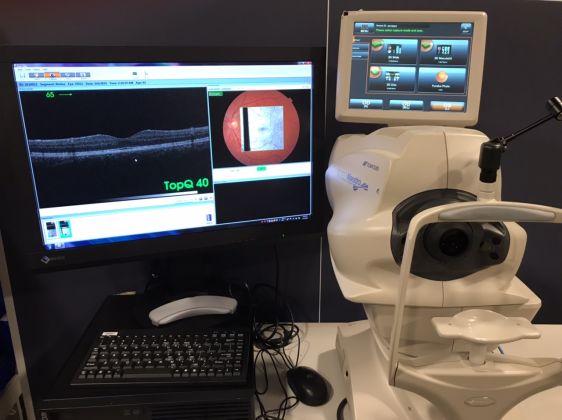 Topcon 3D OCT 1 Maestro system