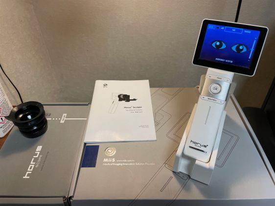 Horus hand held fundus camera
