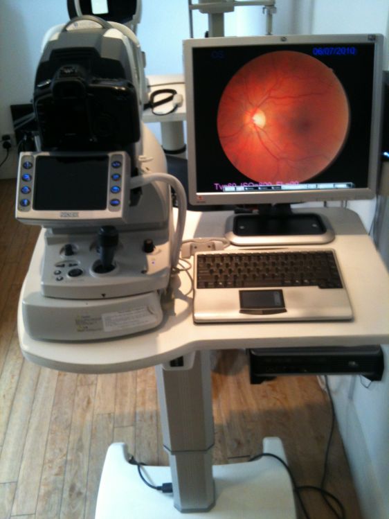Nidek AFC 210 Fundus Camera