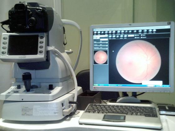 Nidek Non-Mydriatic Auto Fundus Camera
