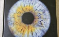 Atlas of Clinical Ophthalmology